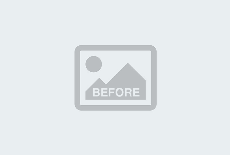 Before Image: Carriere Motion Appliance & Braces - front