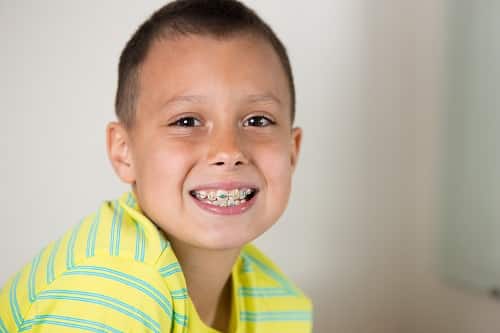 Boy brushing his teeth. 1766076260 braces child patient 1 Braces in Denver, CO