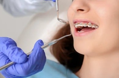 teenage-girl-dental-braces-visiting-260nw-1696417084 A close-up shot of a girl getting emergency orthodontic care in Denver